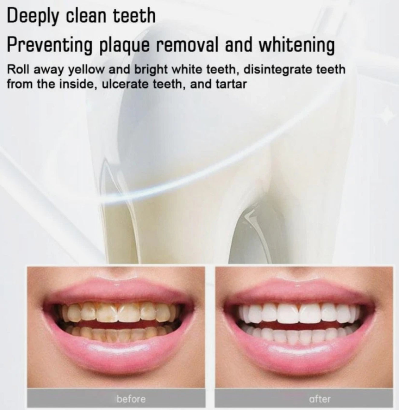 SP6 Ultra Whitening Zahnpasta – Probiotische Tiefenreinigung & Aufhellung | Natürliche Formel für frischen Atem & gesundes Zahnfleisch, 140 g