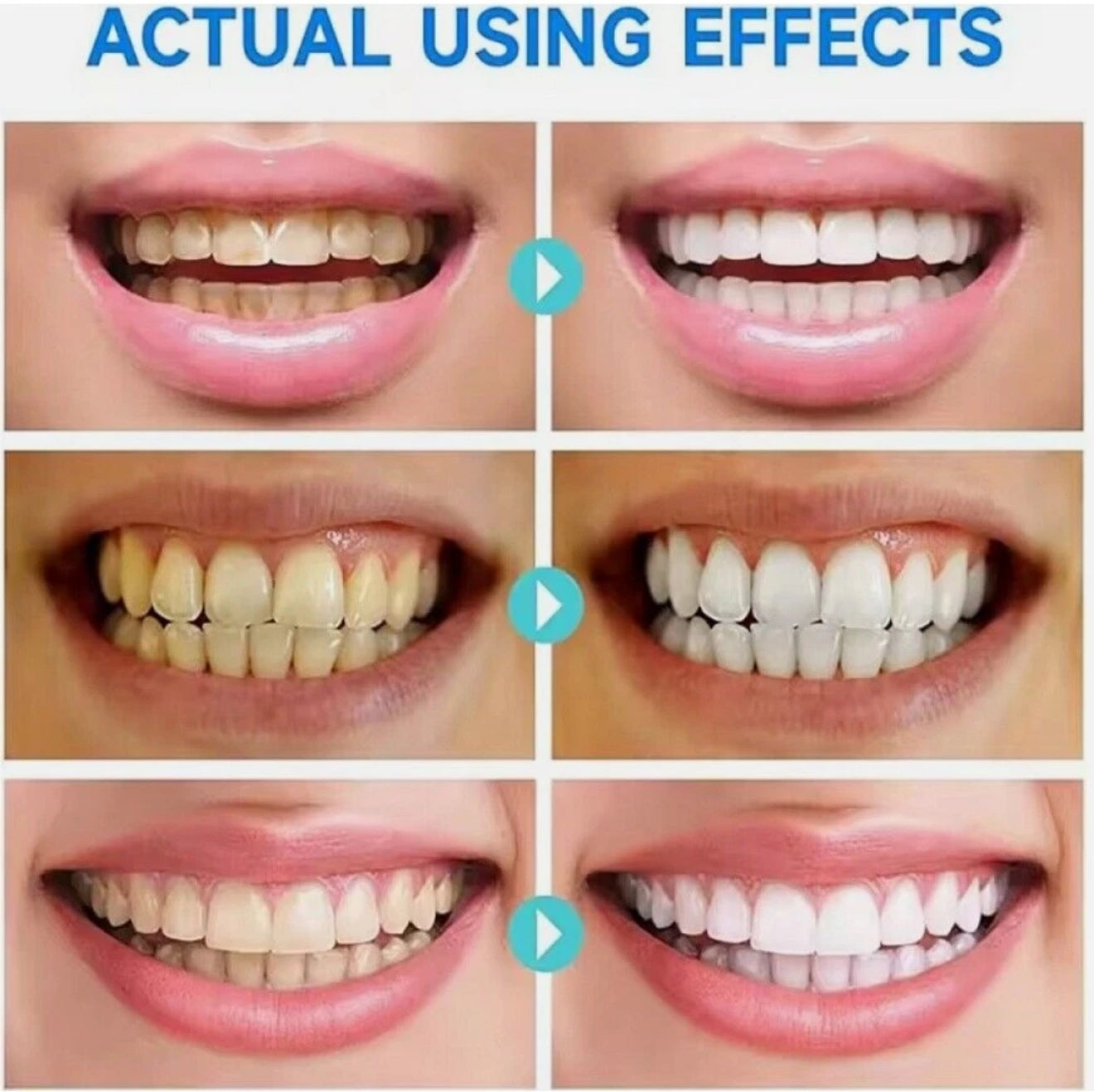 SP6 Ultra Whitening Zahnpasta – Probiotische Tiefenreinigung & Aufhellung | Natürliche Formel für frischen Atem & gesundes Zahnfleisch, 140 g