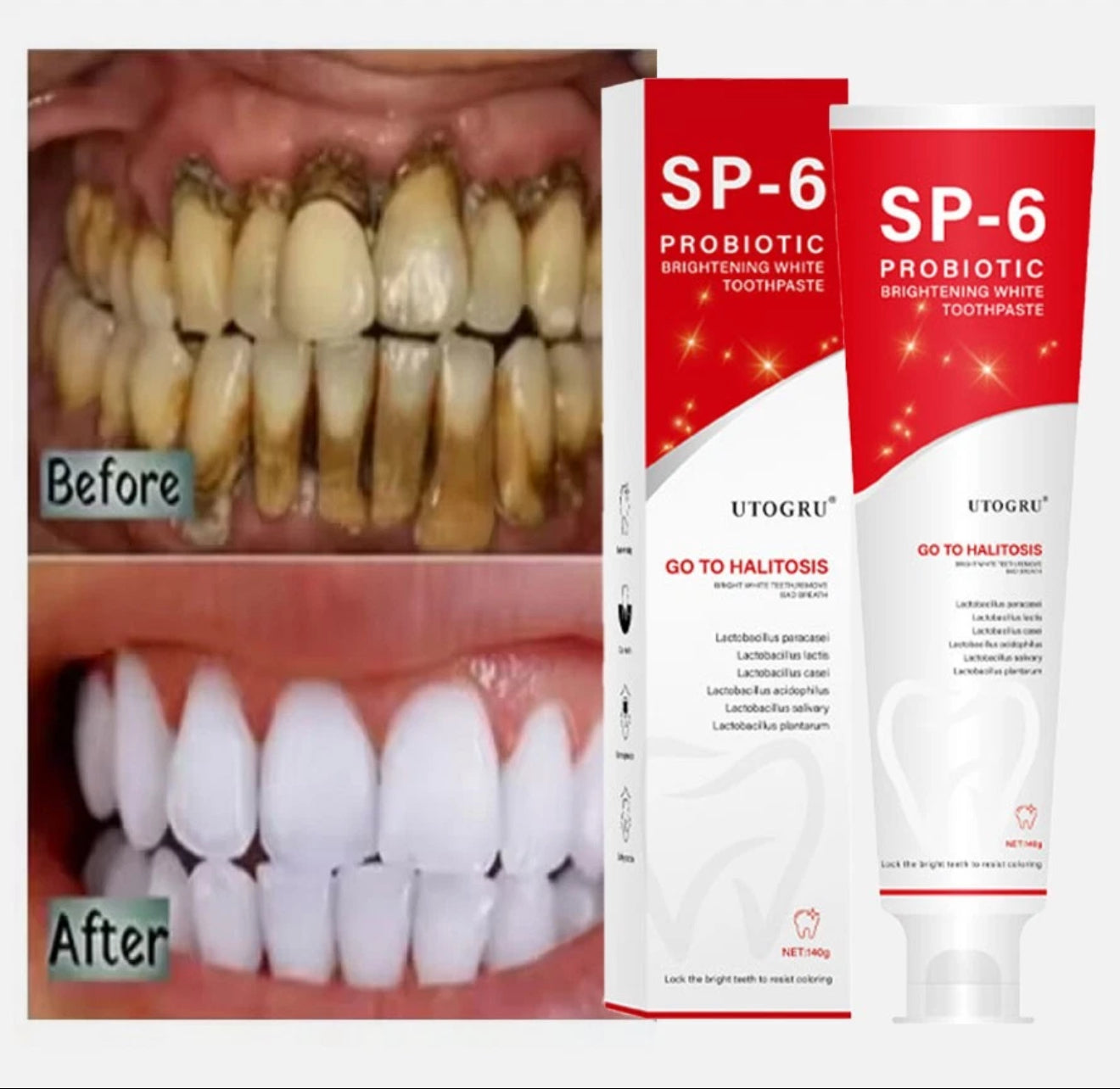 SP6 Ultra Whitening Zahnpasta – Probiotische Tiefenreinigung & Aufhellung | Natürliche Formel für frischen Atem & gesundes Zahnfleisch, 140 g