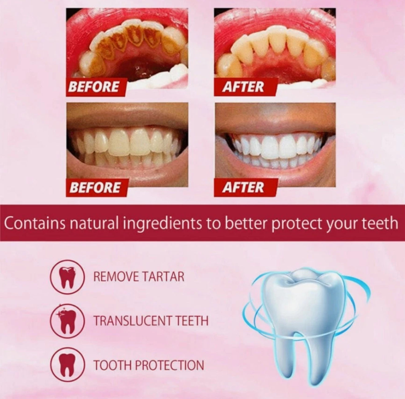 SP6 Ultra Whitening Zahnpasta – Probiotische Tiefenreinigung & Aufhellung | Natürliche Formel für frischen Atem & gesundes Zahnfleisch, 140 g