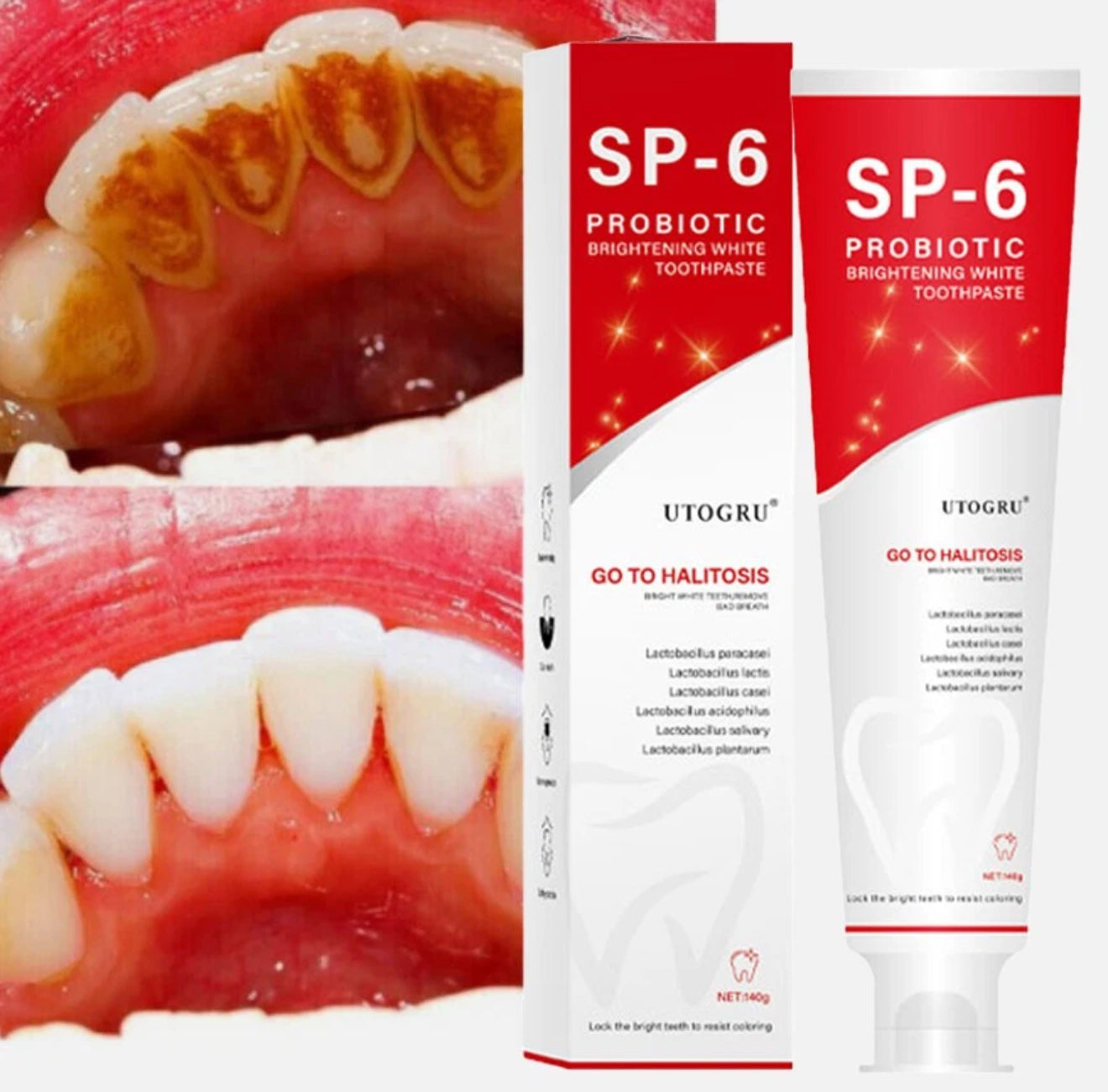 SP6 Ultra Whitening Zahnpasta – Probiotische Tiefenreinigung & Aufhellung | Natürliche Formel für frischen Atem & gesundes Zahnfleisch, 140 g