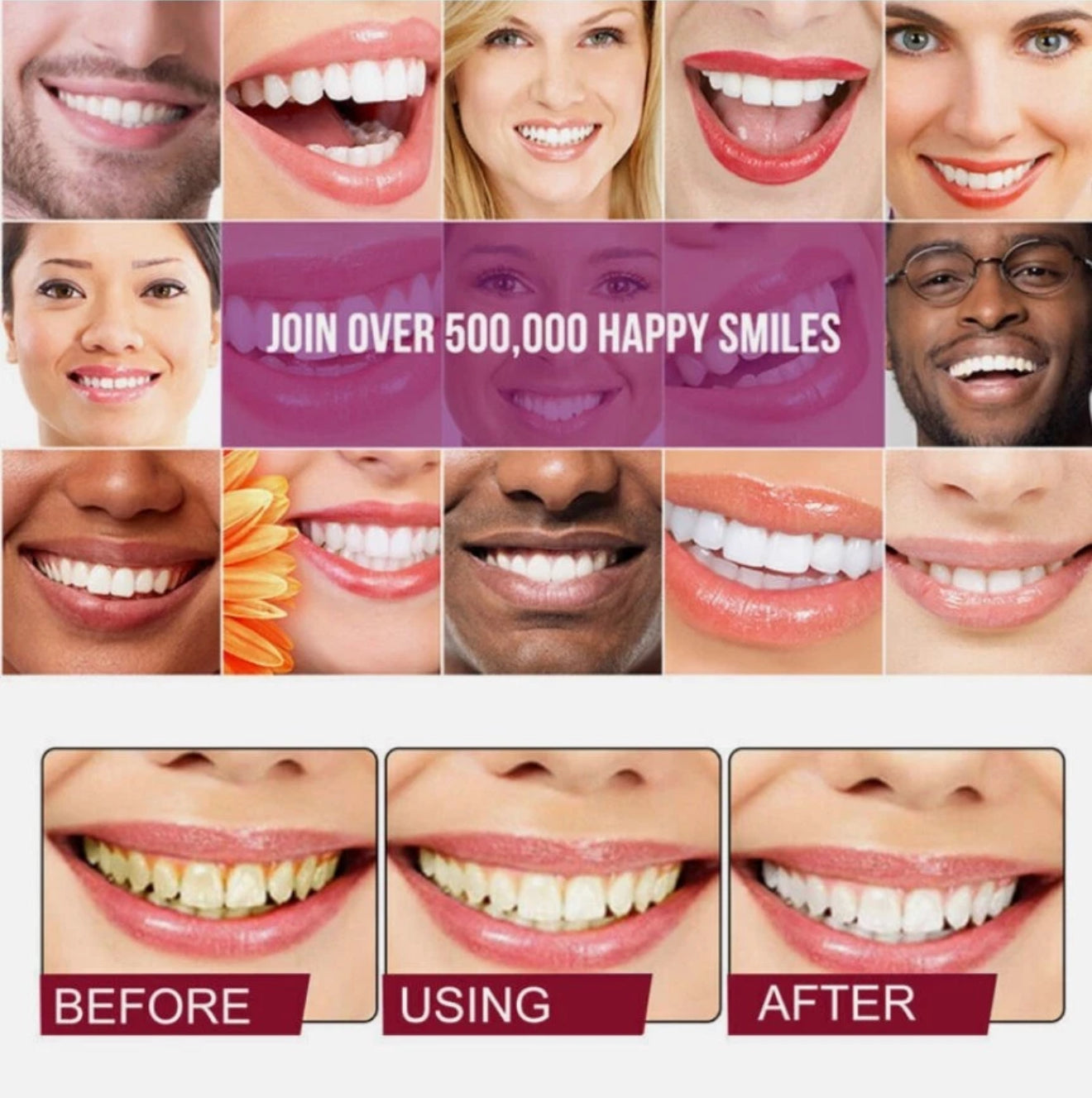 SP6 Ultra Whitening Zahnpasta – Probiotische Tiefenreinigung & Aufhellung | Natürliche Formel für frischen Atem & gesundes Zahnfleisch, 140 g